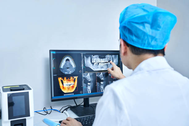 Best Emergency Root Canal Treatment in Lynnwood, WA